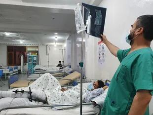 En la Unidad de Urgencias de Traumatología de MSF en Kunduz, un médico examina la radiografía de un paciente que ha sufrido una fractura en la pierna debido a la explosión de una bomba. (Crédito: Stig Walravens/MSF )