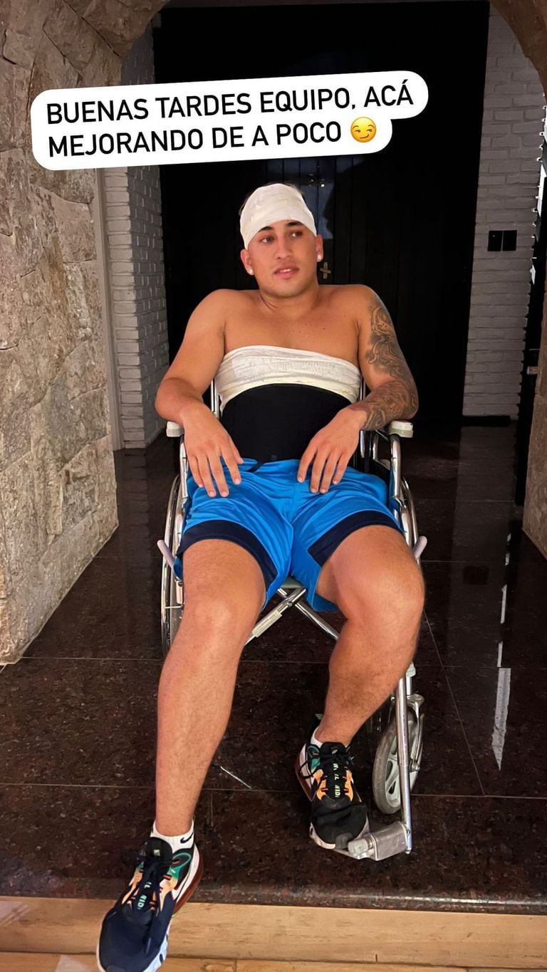 Yao Cabrera showed how it looked after the accident (Photo: Instagram)