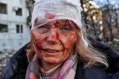 Ucrania celebra la recuperación de una mujer que le puso cara a la violencia de los solados de Putin