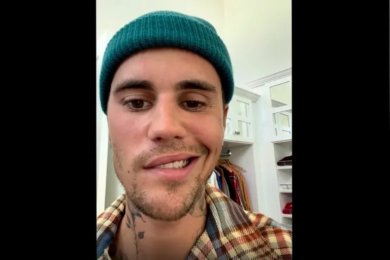 Il video scioccante di Justin Bieber, semiparalizzato, che spiega perché ha dovuto cancellare i suoi spettacoli.