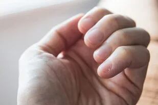 Cómo tus uñas te ayudan a detectar enfermedades