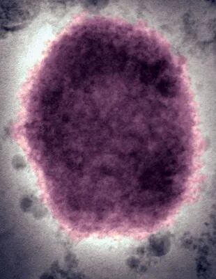 El virus que provoca la viruela del mono fue identificado en 1958