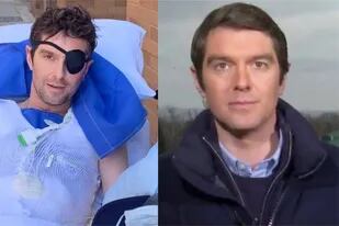 Reapareció el periodista de Fox News que sobrevivió a un ataque cerca de Kiev: perdió media pierna y un ojo "ya no funciona"