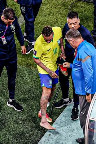 Así se veía el tobillo derecho de Neymar tras irse del campo de juego
