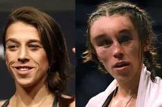 UFC: el dramático antes y después de la polaca Joanna Jedrzejczyk tras su pelea
