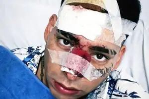 Kaleb Di Masi chocó contra un patrullero en la Autopista del Oeste y sufrió serias heridas.