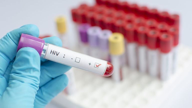 Descubren una nueva variante del VIH más contagiosa y virulenta que circula en Países Bajos - LA NACION