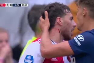 Orkun Kokcu con la cara ensangrentada por el arañazo de Carrasco; el jugador de Atlético de Madrid se enloqueció en un amistoso y generó la reacción del Cholo Simeone