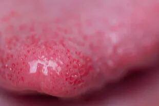 Los puntos rojos en la lengua podrían indicar que hay deficiencia de vitaminas como el ácido fólico, la b12 o hierro