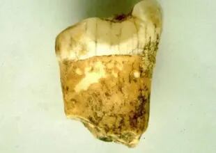 Un primer molar de un neandertal, analizado para este estudio