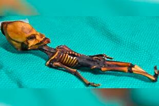 El esqueleto de Ata sobre una mesa de examinación