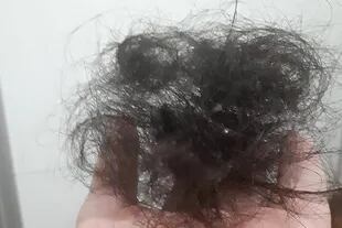 Yamila Álvarez Coll asegura que la caída del pelo post Covid le dejó un 30% de su cabellera. 