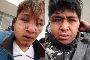 Dos de los jóvenes golpeados durante el procedimiento policial
