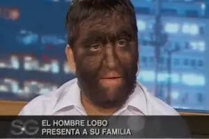 El "hombre lobo" que ganó un récord Guinness en el 2000 y estuvo en el living de Susana Giménez