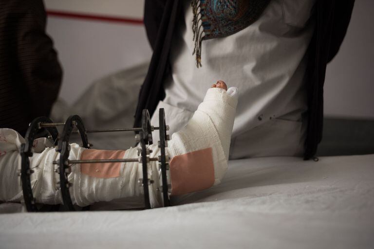 25-02-2019 Un niño herido a causa de la explosión de una bomba en Afganistán POLITICA INTERNACIONAL CONTACTO