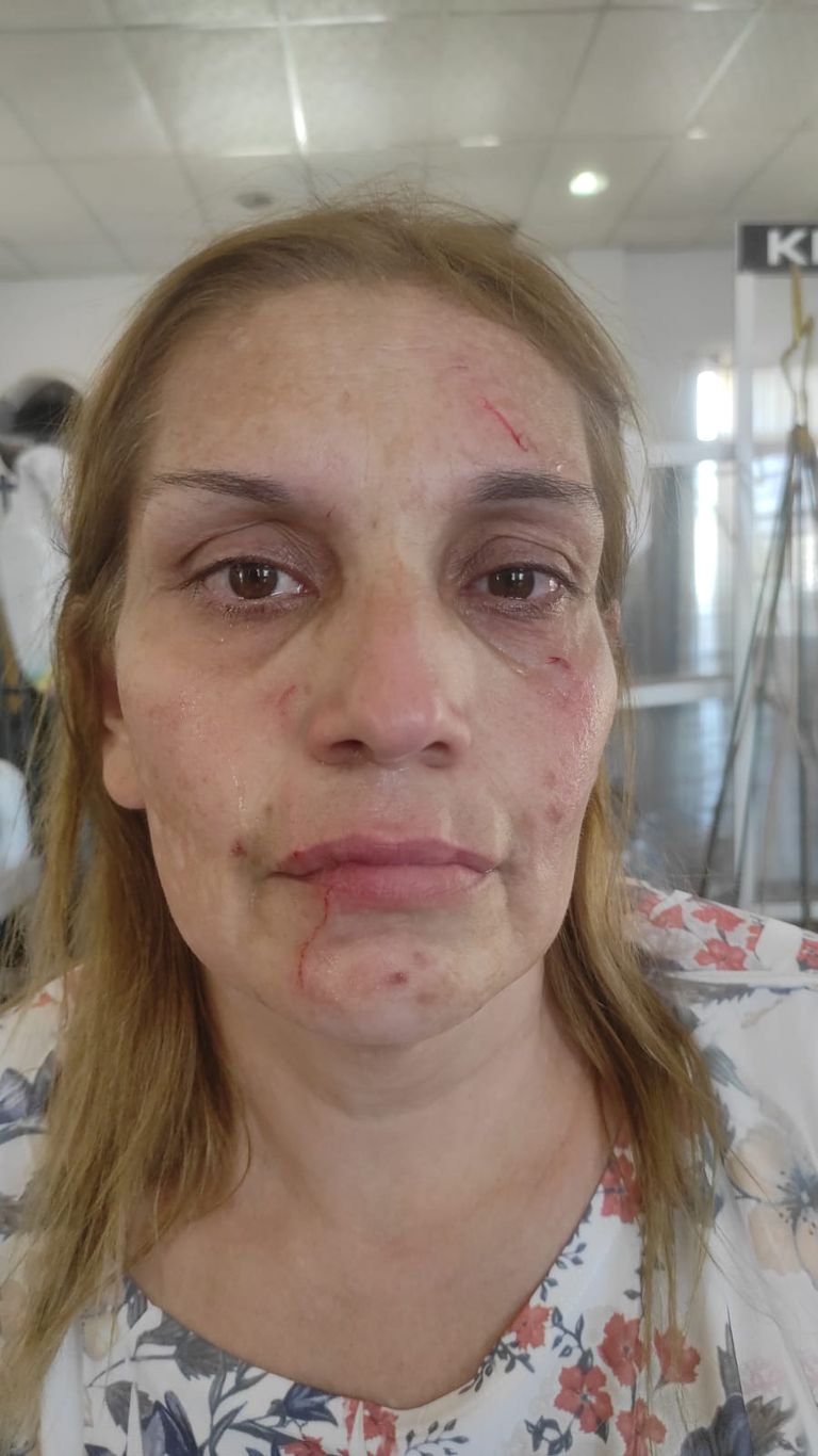 Violencia en La Rioja, una empleada fue atacada durante un intento de toma