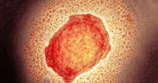 Así se ve una partícula del virus de la viruela de los monos en el microscopio