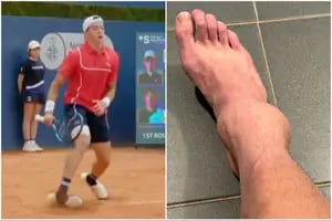 La terrible lesión de un tenista que recordó al tobillo de Maradona en Italia '90
