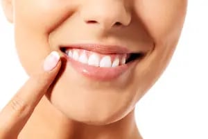 Cómo blanquear los dientes: muchos mitos y algunas verdades