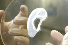 Por primera vez implantan en un paciente una oreja impresa en 3D a partir de células humanas