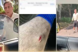 El hombre tuvo un feroz ataque contra el joven, generándole daños en las piernas (Foto captura LAM)