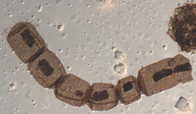 12-01-2022 Microfotografía del fósil Arctacellia tetragonala, uno de los primeros fósiles inequívocos de eucariotas fotosintéticos. POLITICA INVESTIGACIÓN Y TECNOLOGÍA MC SFORNA / UNIVERSITY OF LIÈGE