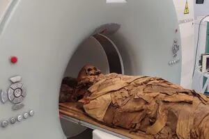 Practicaron una tomografía computarizada a una momia egipcia de hace 3000 años