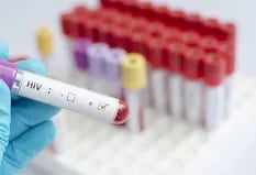 Descubren una nueva variante del VIH más contagiosa y virulenta