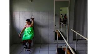 Una paciente con quemaduras hace ejercicios en el Instituto de Apoyo a Víctimas de Quemaduras en Fortaleza