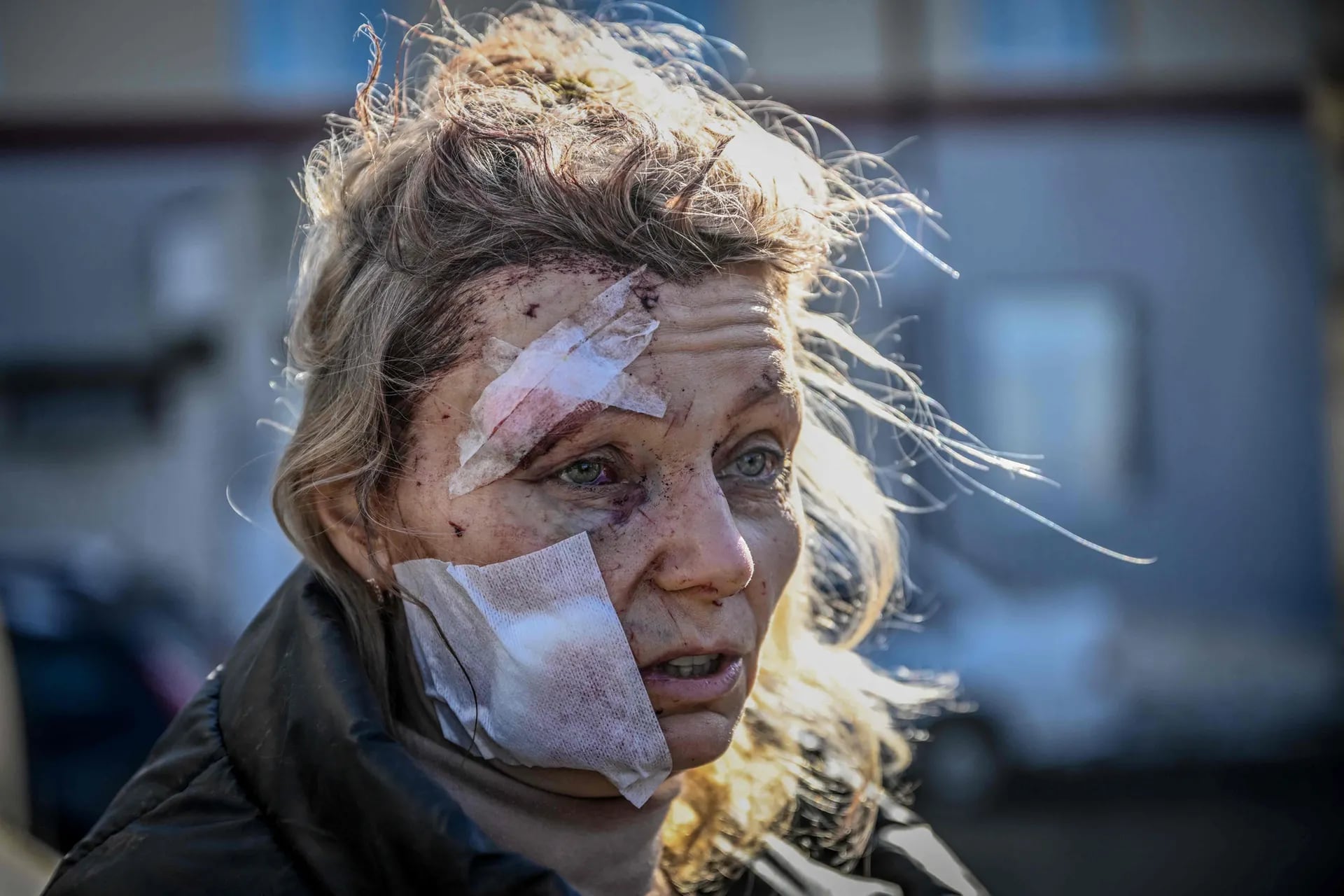 Una mujer herida frente a hospital despuis del bombardeo de la ciudad de Chuguiv, en elte de Ukraia