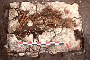Un grupo de arqueólogos rusos descubrió el cráneo de un hombre de 5000 años de antigüedad que fue sometido a una antigua forma de cirugía cerebral y que probablemente causó su muerte