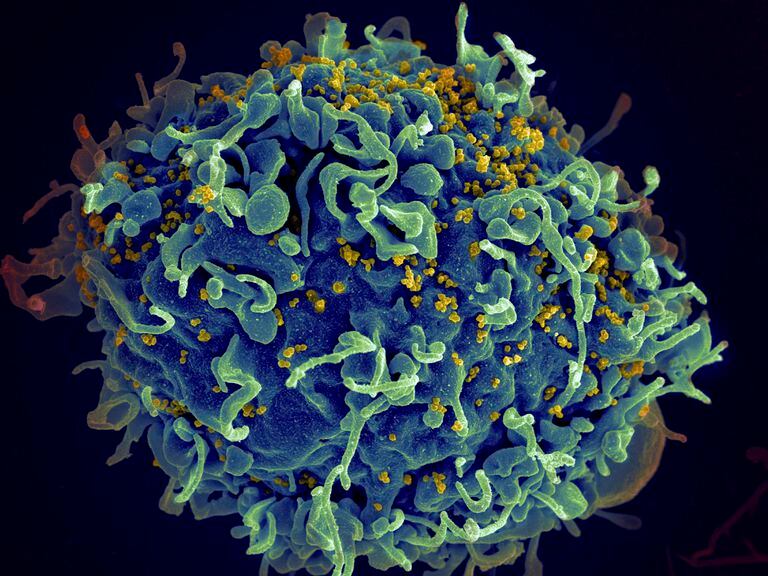 En esta imagen de archivo, distribuida por los Institutos Nacionales de Salud de Estados Unidos, se muestra una célula T humana (en azul) atacada por el VIH (en amarillo) al microscopio