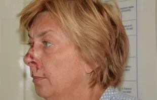 La mujer fue encontrada desorientada y con golpes en la cara
