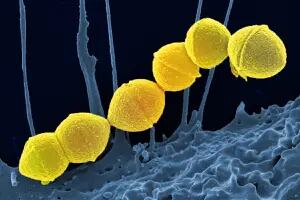 Crece la preocupación por la bacteria Streptococcus pyogenes, que ya causó 64 muertes en el país