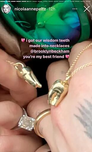 Una captura del instagram storie que publicó Nicola con las muelas bañadas en oro