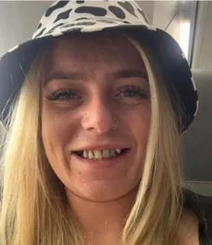 Paige Griffin sufrió bullyng durante su infancia por la mal formación de sus dientes