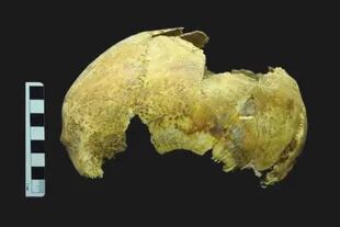 Los científicos compararon las imágenes del cráneo desenterrado con imágenes en 3D para deducir si el hombre había sufrido una trepanación, una técnica quirúrgica antigua muy popular en la que se hacía un agujero en el cráneo