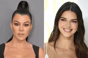 La tendencia de estética facial que pusieron de moda las Kardashians