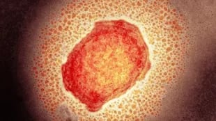 Una partícula del virus de la viruela del mono