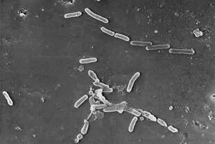 La bactería Pseudomonas aeruginosa puede causar infecciones en los pulmones, la sangre y otras partes del cuerpo