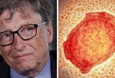 El pronóstico que Bill Gates hizo sobre la viruela y podría estar próximo a volverse realidad