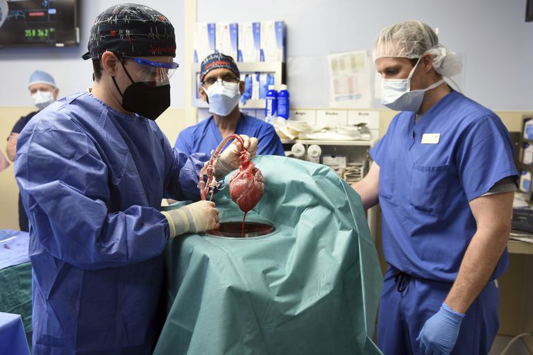 En esta fotografía proporcionada por la Facultad de Medicina de la Universidad de Maryland, unos médicos muestran un corazón de cerdo que fue trasplantado al paciente David Bennett, el viernes 7 de enero de 2022, en Baltimore. (Mark Teske/Facultad de Medicina de la Universidad de Maryland vía AP)