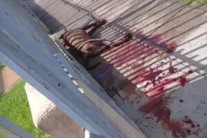 Morón: un pitbull atacó en cadena a cinco vecinos y la policía le disparó y mató