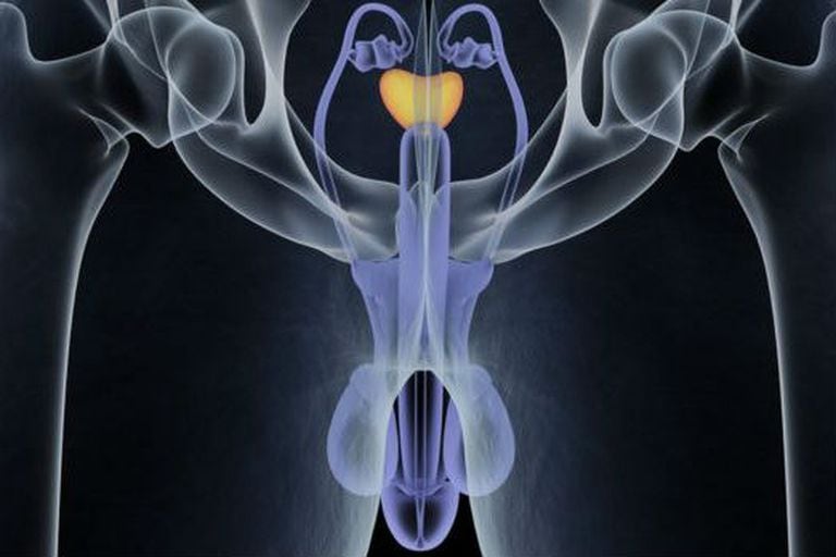 El control temprano es clave para tratar el cáncer de próstata y un pronto diagnóstico es importante para un mejor tratamiento