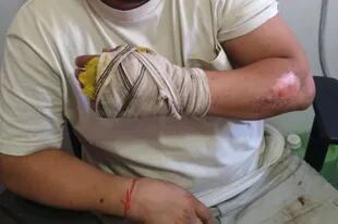Leonel Maximiliano Barrios, acusado del intento de femicidio de Rocío Micaela Cortés en el momento de ser detenido, con marcas de quemaduras