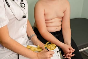 Las nuevas recomendaciones de los pediatras en EE.UU. para tratar la obesidad infantil
