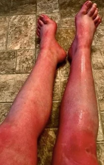 La mujer solo debe tomar medio vaso de agua al día