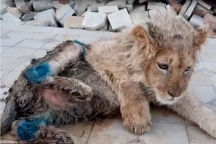 Le realizaron una cirugía que provocó un milagro y pudo volver a caminar