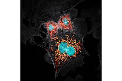 10. Células endoteliales de una arteria pulmonar bovina, en la etapa de telofase de la división celular (Jason Kirk, Estados Unidos)