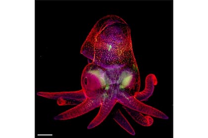 19. Embrión de un pulpo (Martyna Lukoseviciute, Carrie Albertin, Reino Unido)